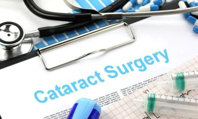 Cataract Surgery