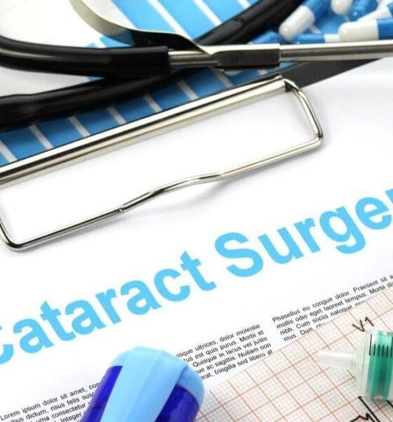 Cataract Surgery
